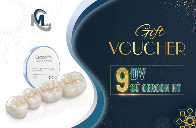 Voucher 9 đơn vị sứ Cercon HT